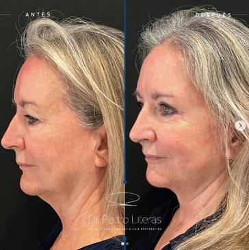 Slider image (2) Dr. Pedro Literas